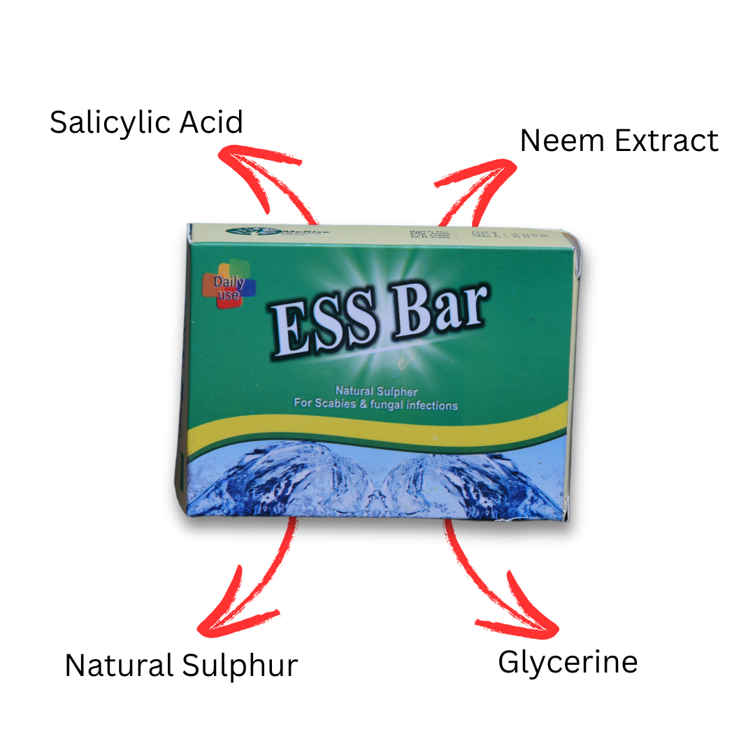 Buy ESS Bar – Sulphur Soap for Scabies and Fungal Infection Treatment