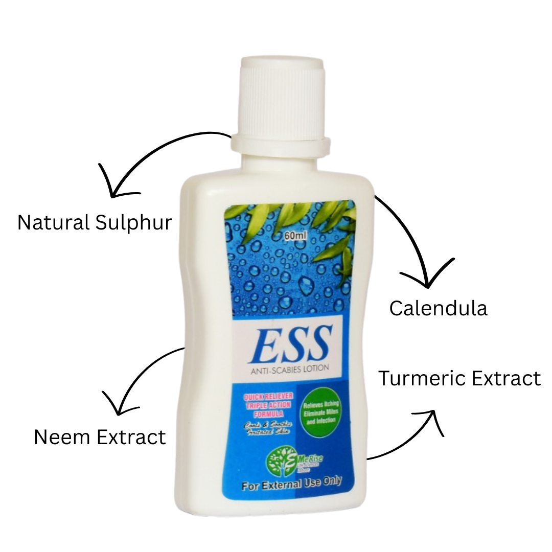 ESS Lotion Best Scabies Treatment & Itch Relief Lotion with Sulfur, Neem & Turmeric 120 ml