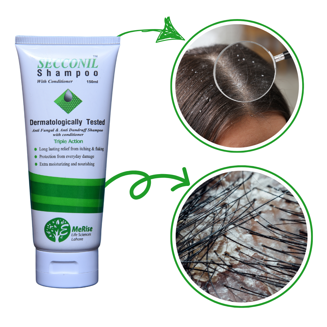 Buy Best Anti-Dandruff & Hair Growth Secconil Shampoo