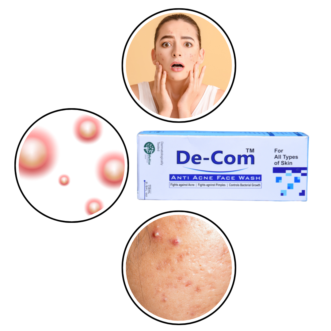 Best Acne Face Wash for Oily & Sensitive Skin