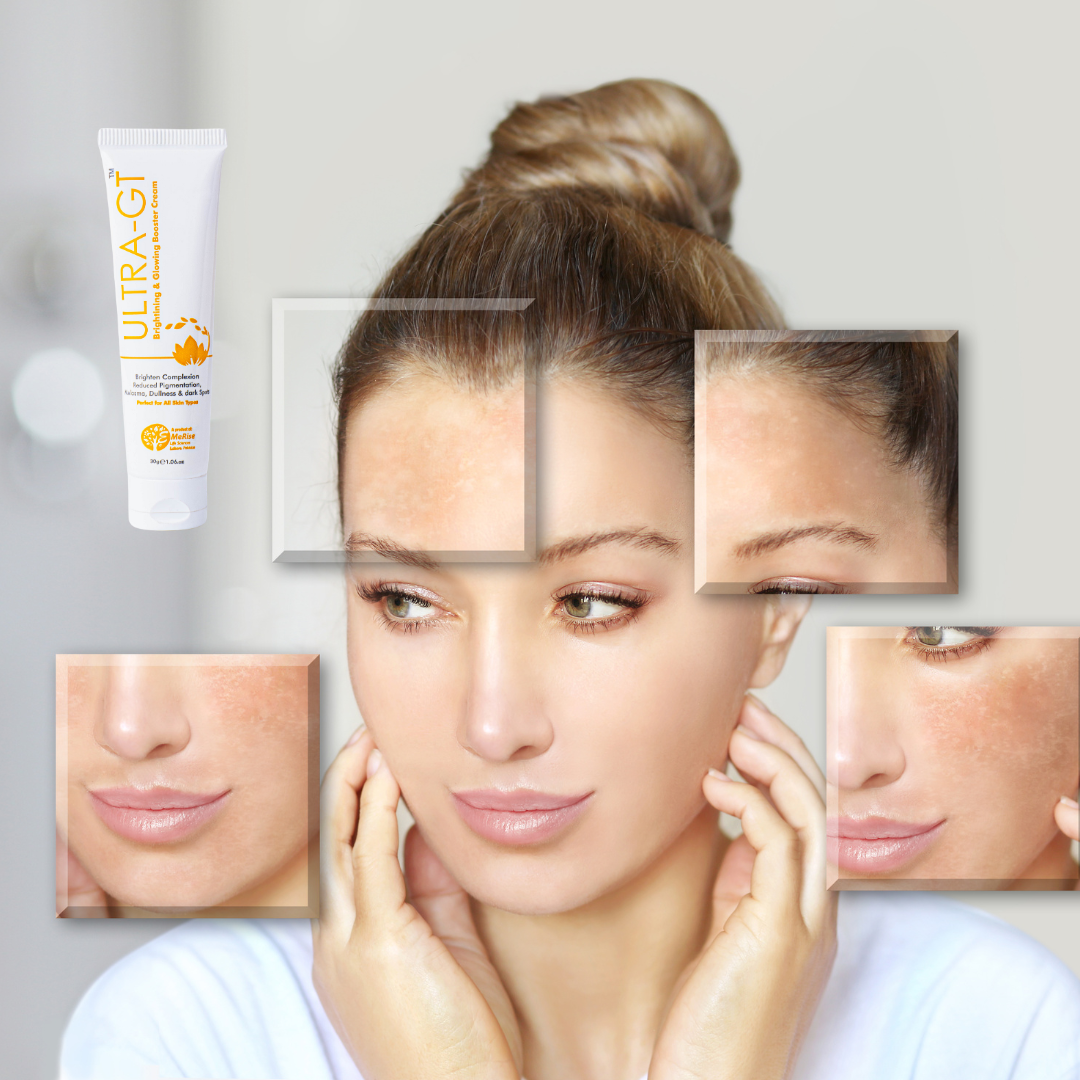 Ultra-GT Cream (Brightening & Glowing Booster Cream) by Emerise Life Sciences – Best Glutathione Skin Whitening Cream in Pakistan