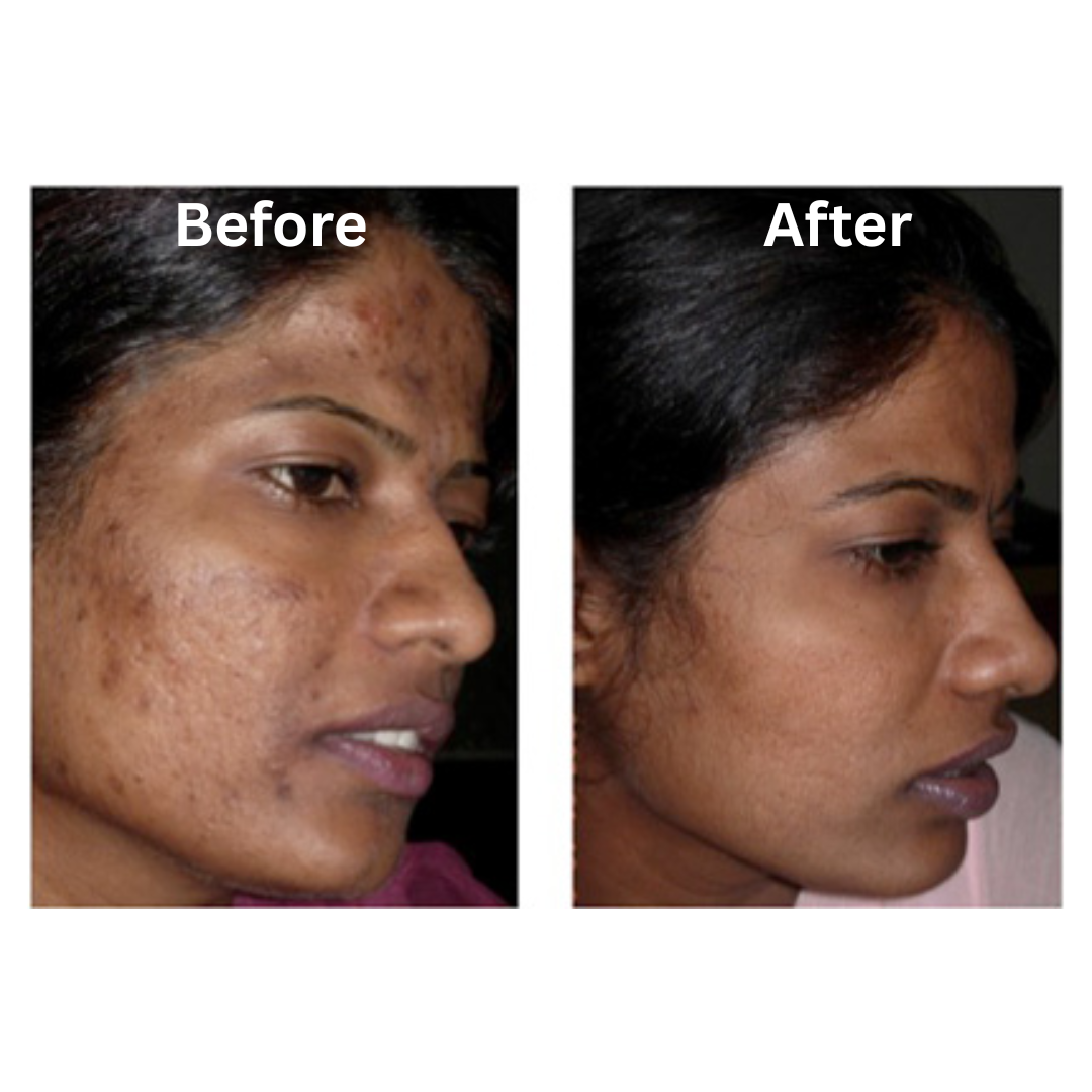Albaderm Cream Advanced Dark Spot & Hyperpigmentation Treatment